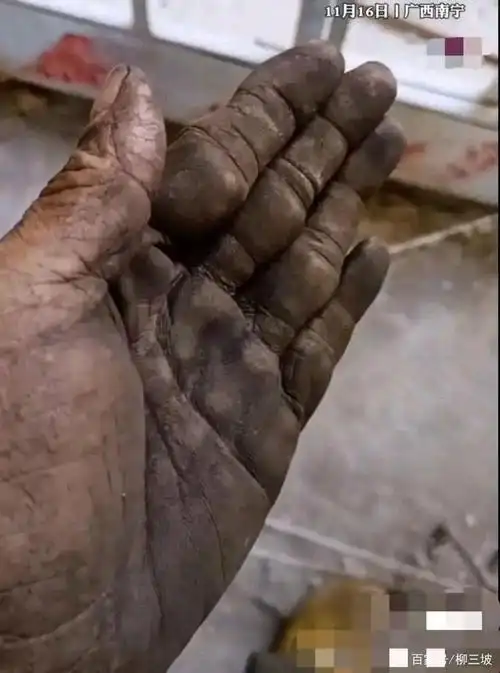 我想告诉这位大哥,有这样的一双手一点不丢人