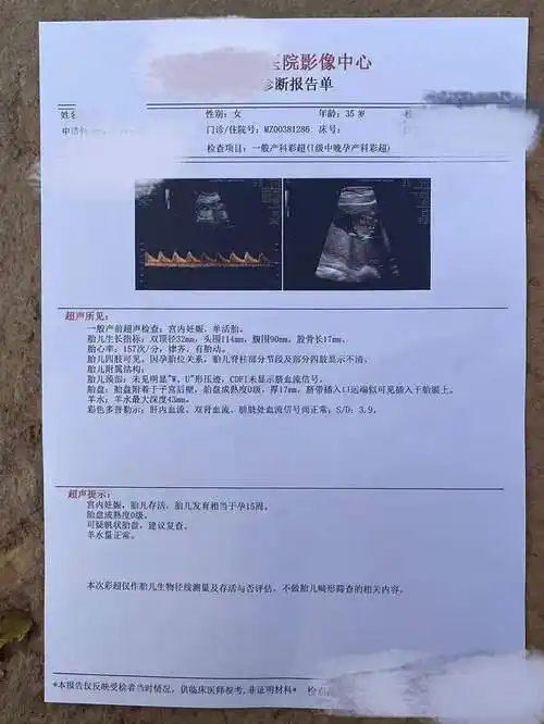 已经更换了产妇信息的检查单跟医院甚至是有关部门合作关系的深浅,是"