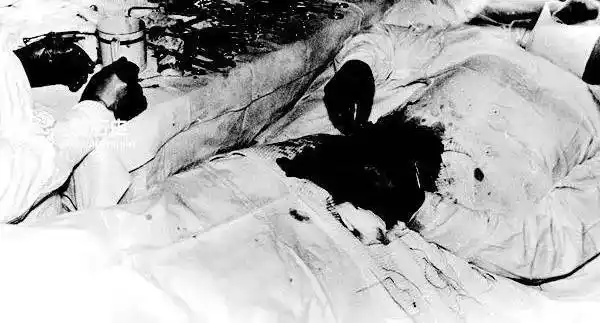 他把自己开膛破肚,这个来自战斗民族的医生给自己做一次外科手术