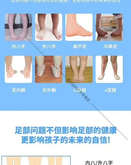 内八字矫正鞋儿童扁平足外翻小孩长短腿马蹄足内翻踮脚纠正器宝宝垫