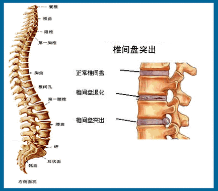 腰椎间盘的日常保护方法