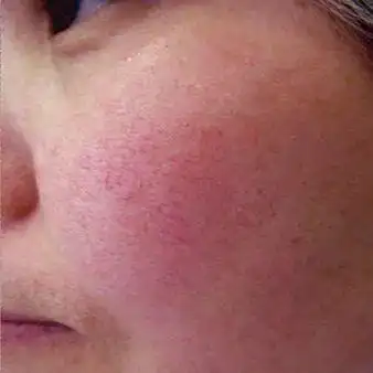 含有这些成分的洗面奶越洗越糙,还超级伤肤,快扔掉!