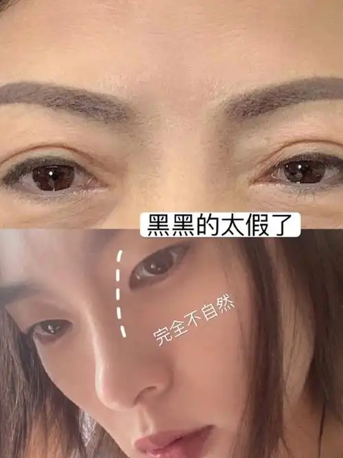 半永久鼻侧影高光?