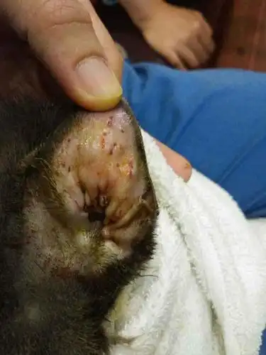 耳血肿的手术治疗