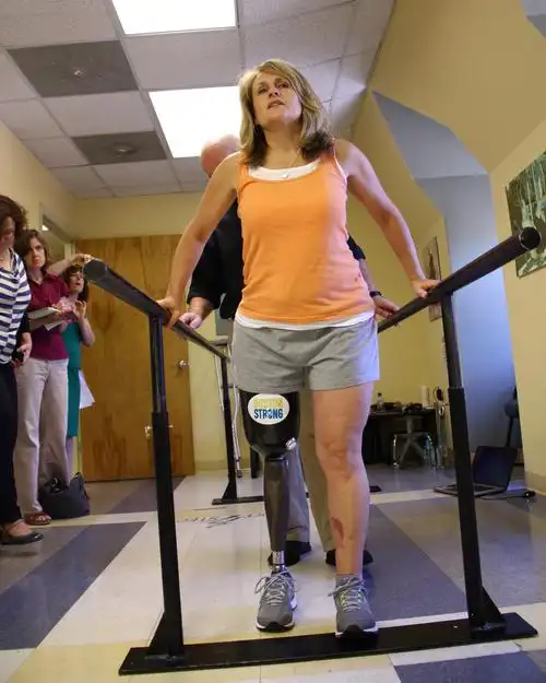 new legs and nagging worries for boston bombing survivors