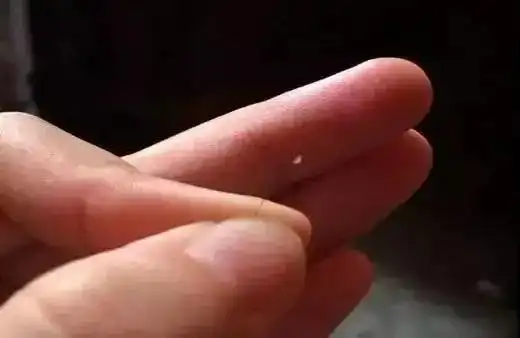 决定头发生死的毛囊,真实面目竟然是这样!脱发的进来看看吧!