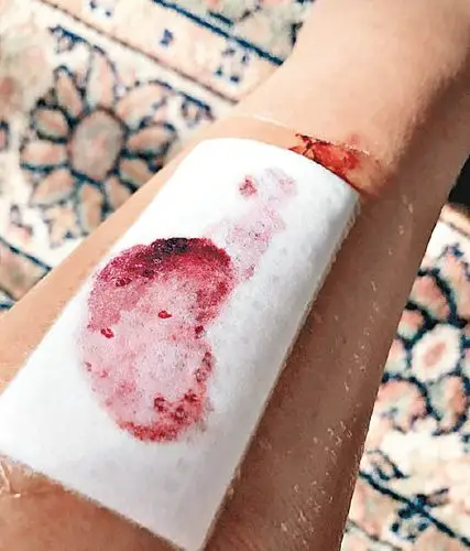 48岁女星发生坠海意外:死里逃生 左脚纱布上都是血