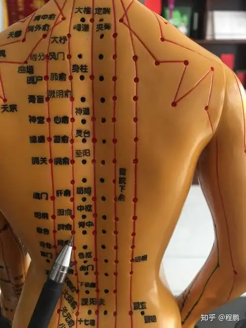 巧用拔罐调理呕吐 - 知乎