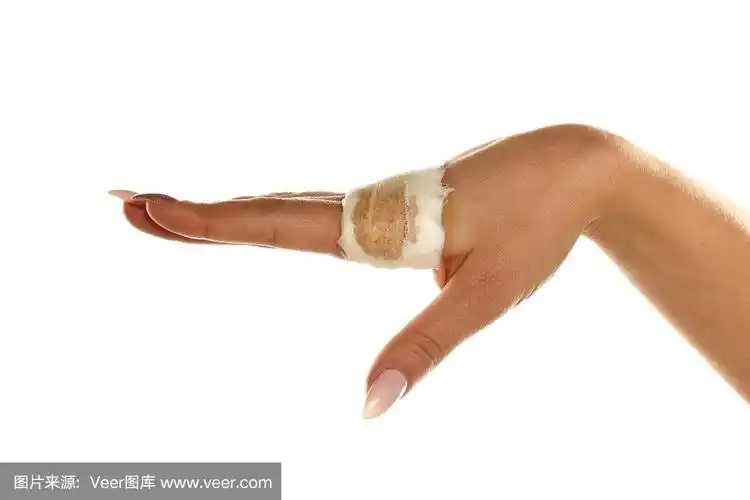 女性受伤的手裹着绷带