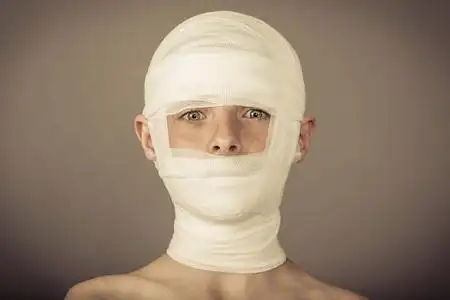 医生用绷带包扎了一个手臂受伤的男孩的手.