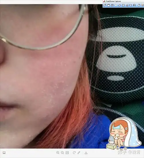 春季不注重皮肤养护你将面临干敏痘斑四大肌肤问题