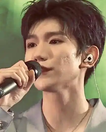 离开十级滤镜的王源,脸上痘坑太明显,看完好像不会再爱了