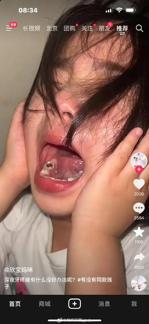 能有啥办法,给孩子牙没看住,烂成这样,疼的半夜直哭,倒是带去治疗啊.