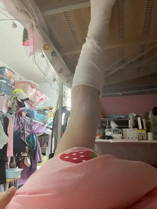 左胫骨骨折骨裂37天拆石膏