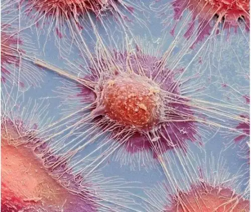 显微镜下的癌细胞竟是这样的11张照片见证神奇世界