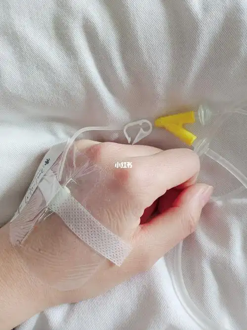 今天终于换了一只手右手已经肿成了猪蹄子整天整天的输液06情况还是