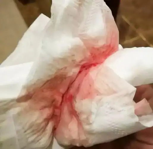 猫吐了粉红色的血,但我却没法出门!