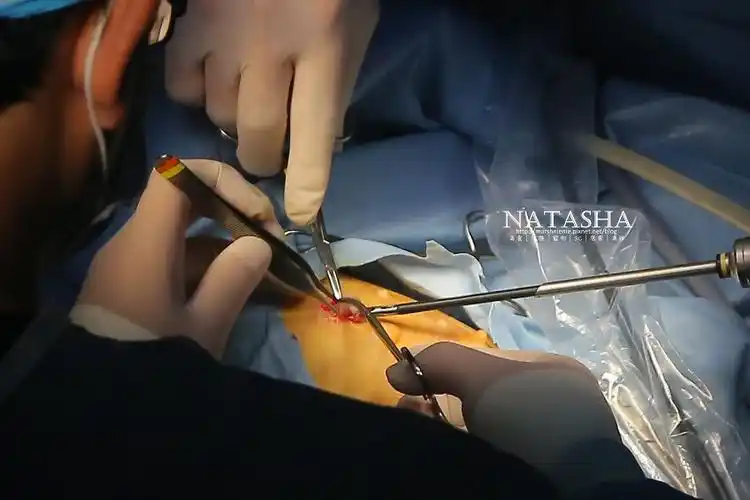 宠物结扎│腹腔镜结扎│手术过程照片影片完整公开.术前评估.