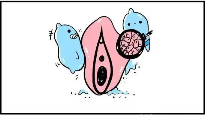 外阴白斑是一种慢性女阴营养不良性疾病.