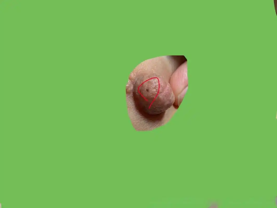 乳头上面最近发现有个黑色之点点,以前有没有我也不记得,最近仔细看