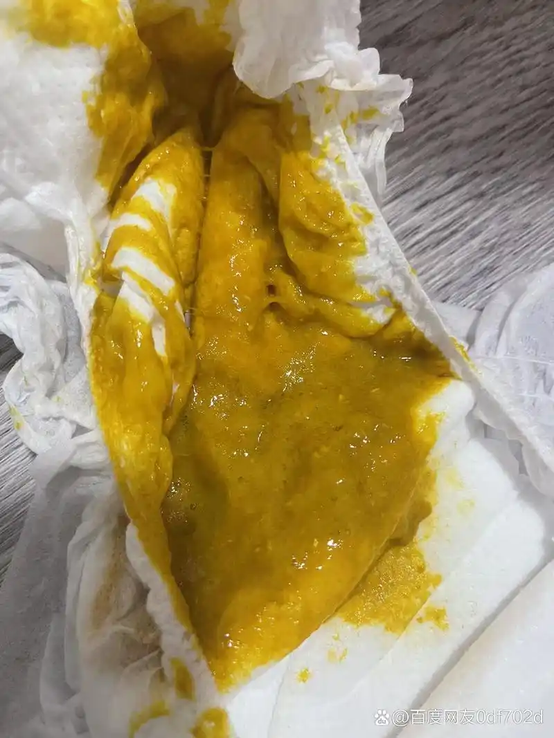 前段时候拉黏液便图2图3,去化验弱阳性轮状病毒,吃了益生菌和药再化验