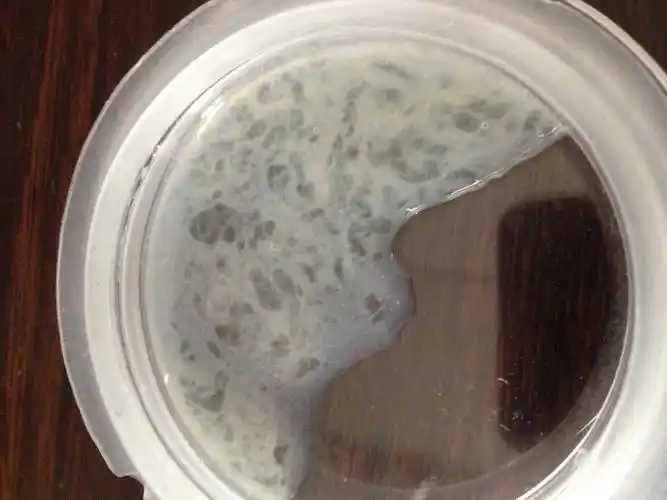 很多人检查后发现自己的精液和果冻一样,一直处于胶状状态.