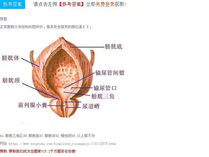 正常膀胱大体结构如图所示,最易发生癌变的部位是().