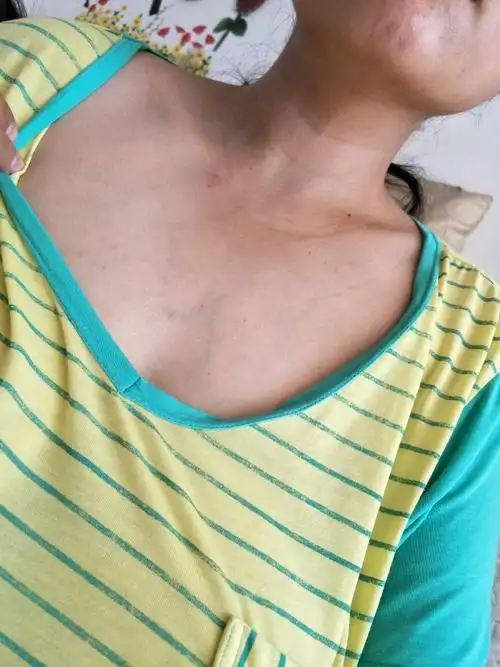 怀孕期间脖子以下胸腔上青筋明显怎么回事