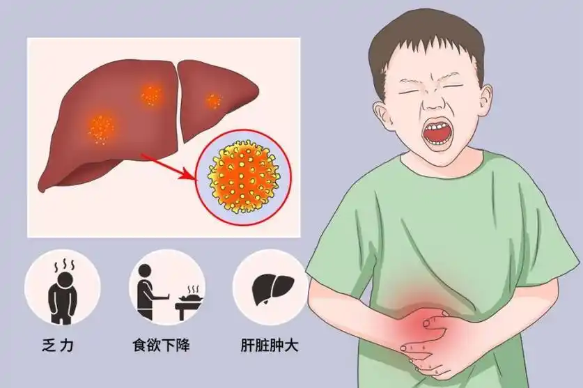 乙肝及丙肝感染人体后均可导致急性肝炎,慢性肝炎或无症状携带者,少数