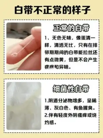 正常白带是什么样子的图片异常白带各种症状图片大全