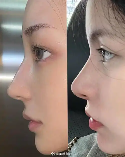 鼻子模板!那个鼻型更适合你