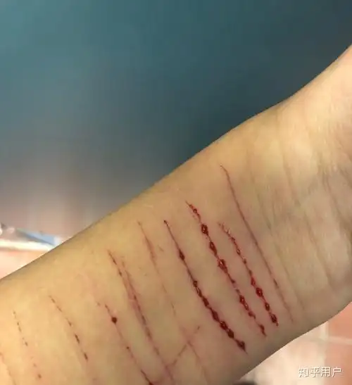 为了一个男生自残值得吗