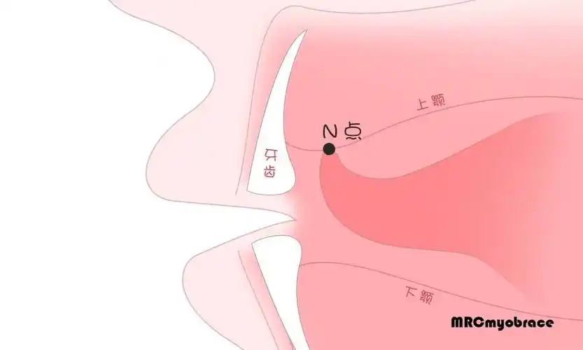 肌功能训练舌位训练2