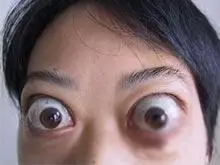 金鱼眼如何消除,我来教你怎么去哦!