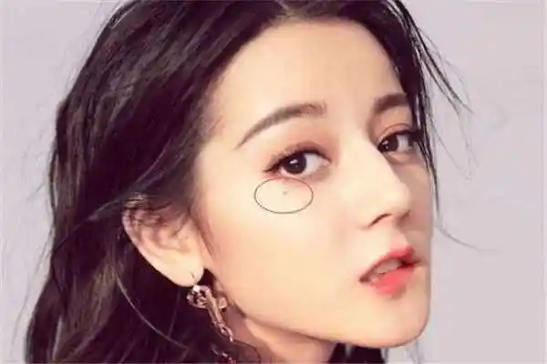 左眼的尾部,这样的痣被称为是桃花痣,这也是万般于宠爱一身的女人面相