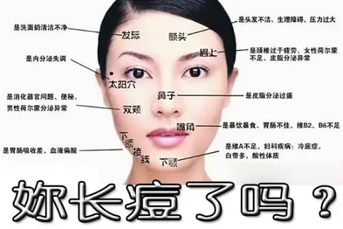 怎么去除痘痘?公开我的祛痘方法!