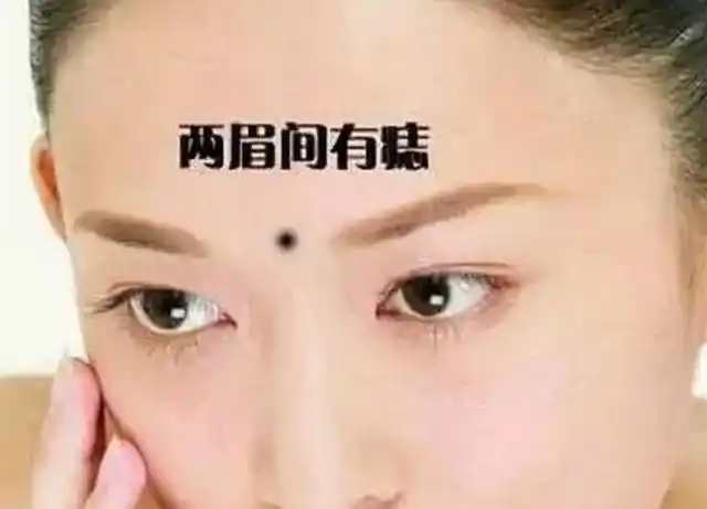 古人成这个位置的凶痣为双龙抢珠,有双龙抢珠,连毁二夫的说法.