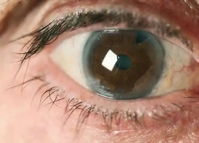 速看盗走光明的小偷青光眼你必须了解这些知识