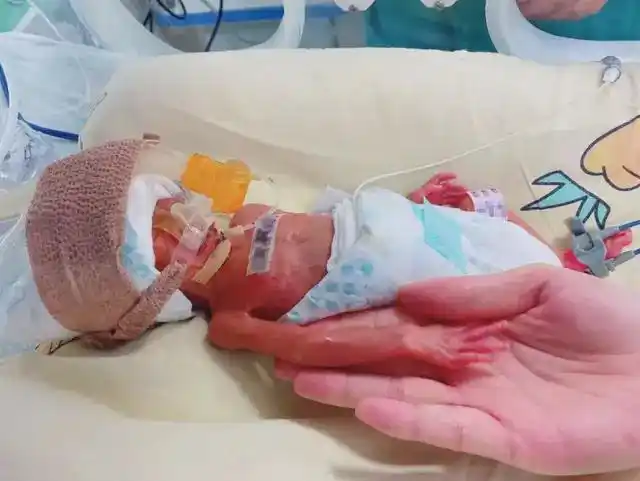 "掌心宝宝"出院啦!出生时胎龄28周,体重仅1040g