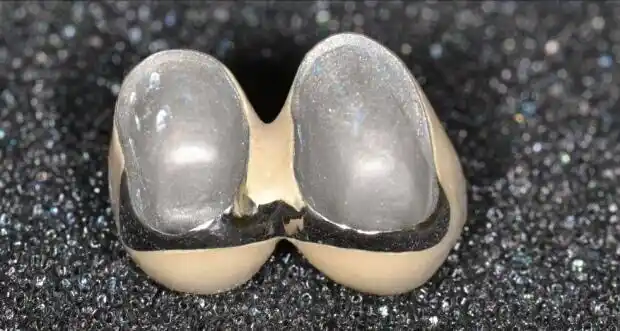 头条问答 - 钴铬合金的烤瓷牙有哪几种?(5个回答)