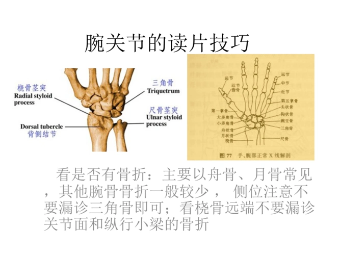 腕关节阅片技巧.ppt