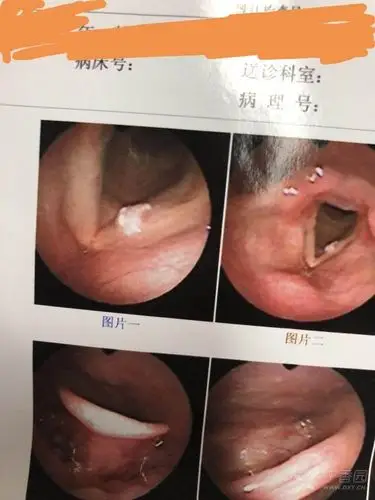 可能涉及到敏感图片,点击后可查看