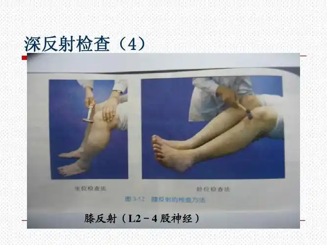 深反射检查(4) 膝反射(l2-4 股神经)