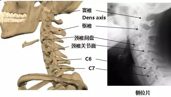 颈椎病的临床诊治技巧