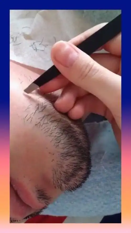 又到了拔胡子的时候了,看到老婆的手忙脚乱,泪水滴我脸上了!