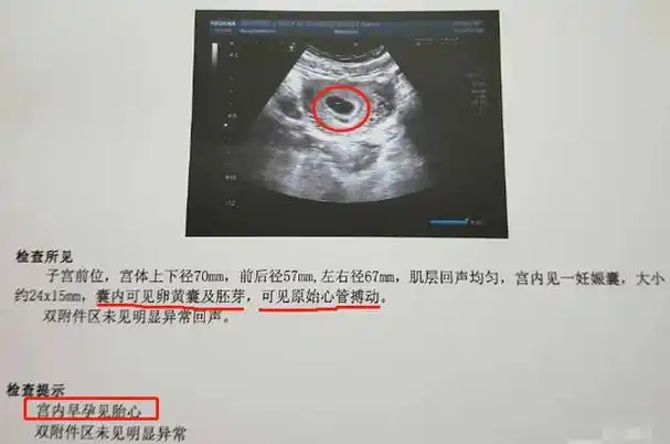 怀孕40多天可以看出男女吗,九个最准怀男孩征兆