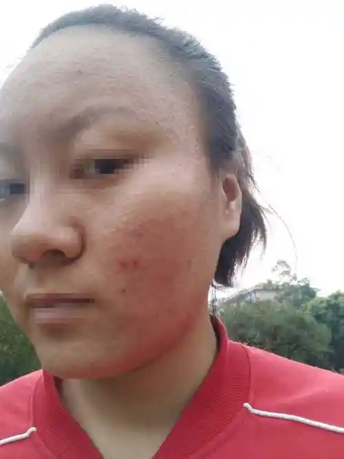 放照片,密集恐惧症捂住眼睛