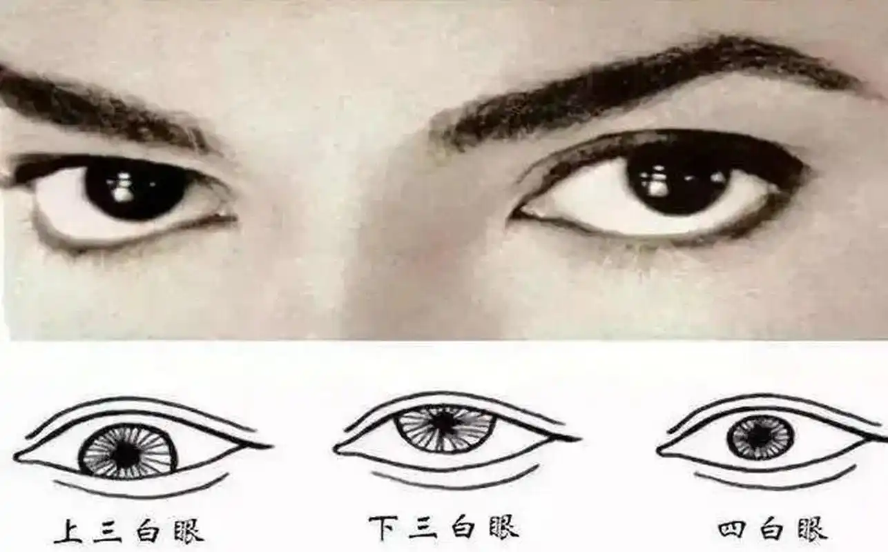 面相学中认为三白眼的人对人比较冷漠无情,六亲不亲,不是好的面相.