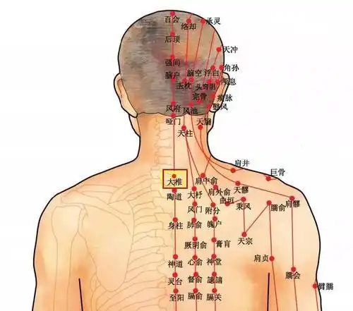 感冒初起时,实用又简单的拔罐治疗法