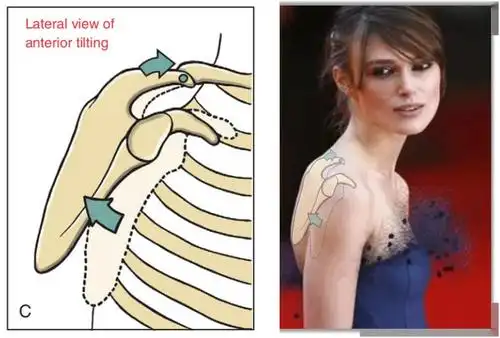 体态大师:为什么不怎么锻炼的女生,斜方肌比肌肉男还发达?_肩胛骨